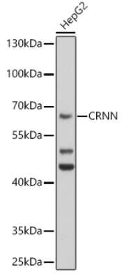 Western Blot: Cornulin AntibodyBSA Free [NBP2-92568]